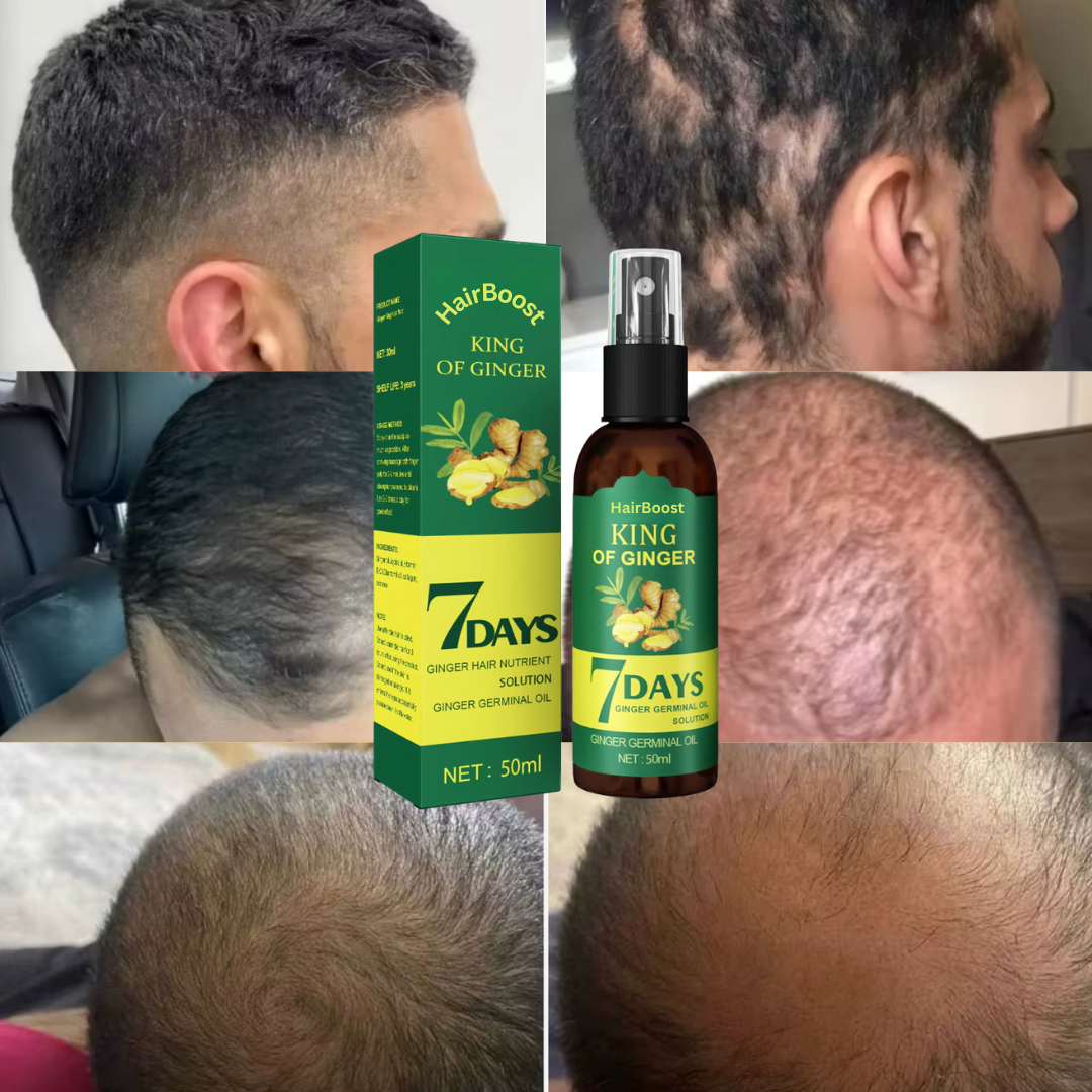 HairBoost: צמיחה מחדש ושיקום שיער עבה וחזק יותר