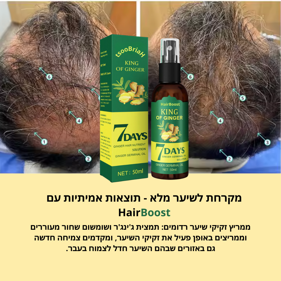HairBoost: צמיחה מחדש ושיקום שיער עבה וחזק יותר